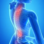 damages for pre existing conditions - back injury