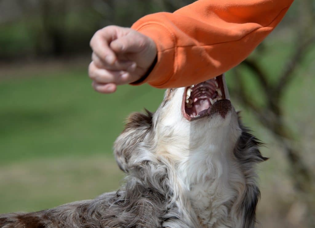 how to treat a dog bite on my hand